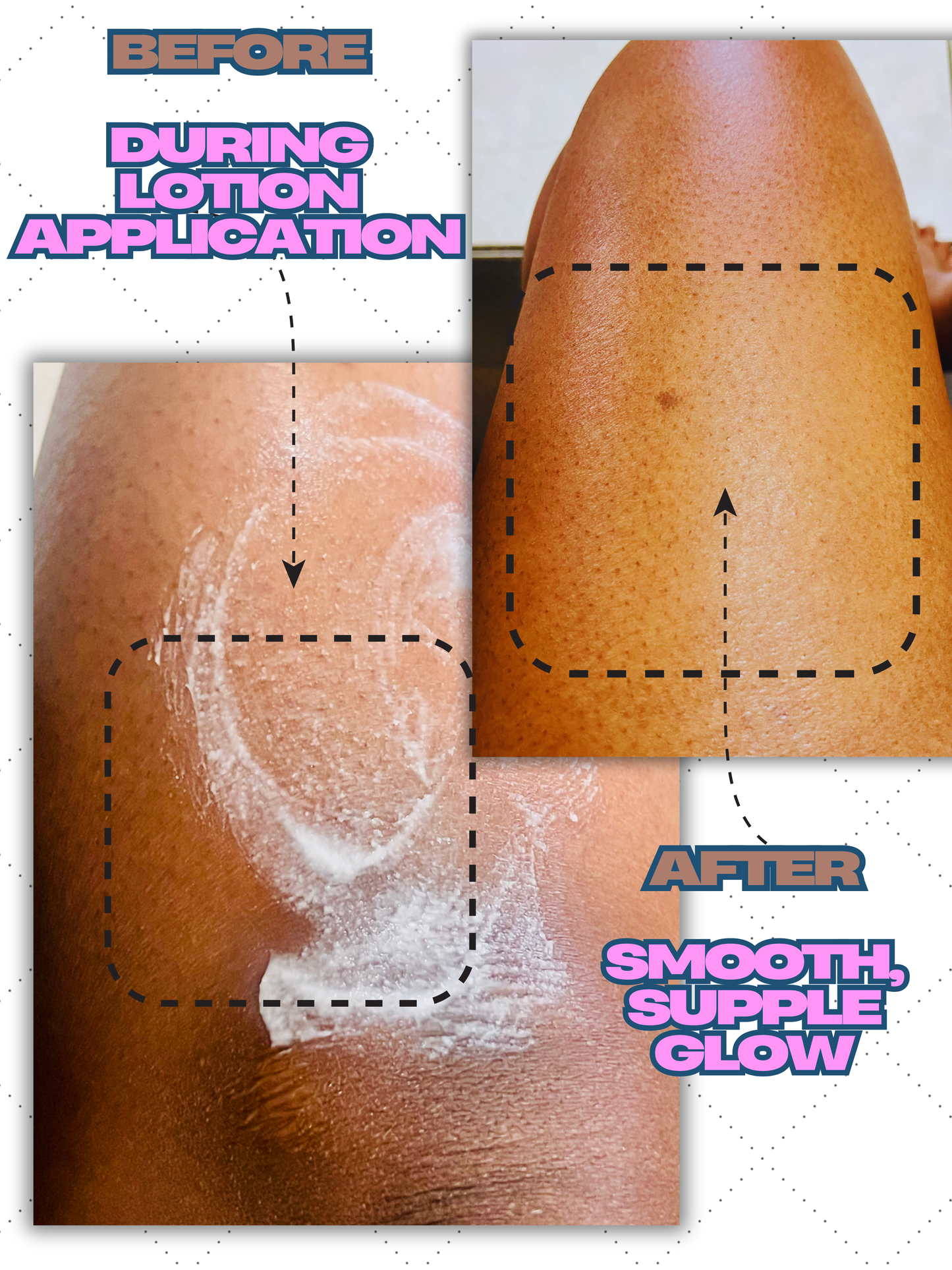Nude ScarCare Body Lotion - Nudebrownsugar
